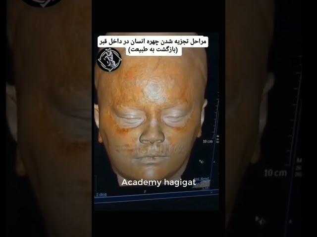 مراحل تجزیه شدن جسد انسان در قبر