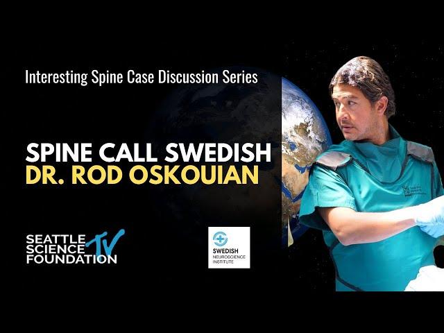 Spine Call Swedish - Rod J. Oskouian, MD