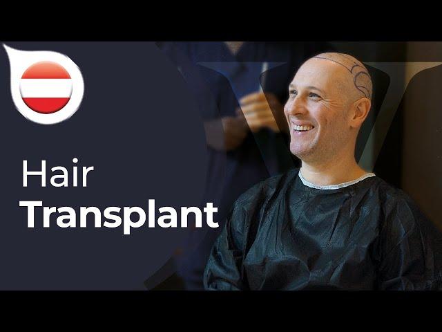 My Experience with Istanbul Vita from Austria | Hair Transplant in Istanbul / Turkey