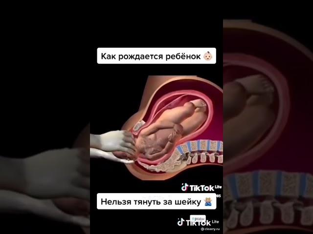 как рождается ребенок #birth of a child #новаяжизнь#роды #акушерам #это интирестно #в тренде #shorts