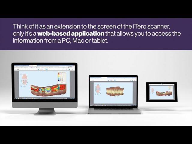 MyiTero.com from Align Technology