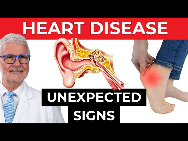 OVERLOOKED Signs Of Heart Disease, DO NOT IGNORE | Dr. Gundry