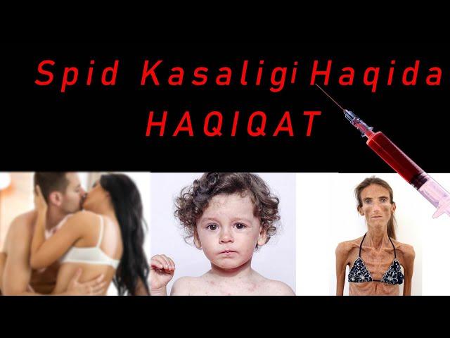 Spid Kasaligi Haqida "HAQIQAT" | Спид Касалиги Хакида Хакикат