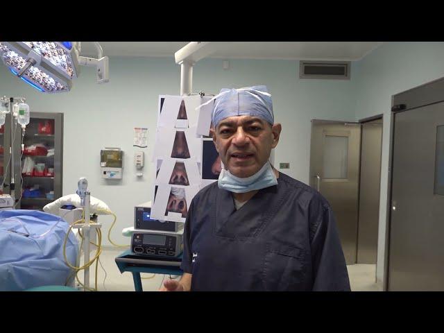 Severely Deviated Nose & Nasal Septum-16: Rhinoplasty Bizrah- London/ Dubai- Dr. Bashar Bizrah