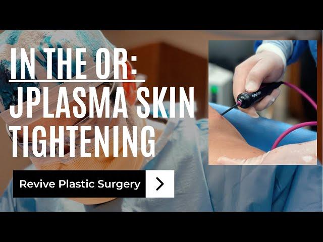 In the OR: JPlasma Skin Tightening