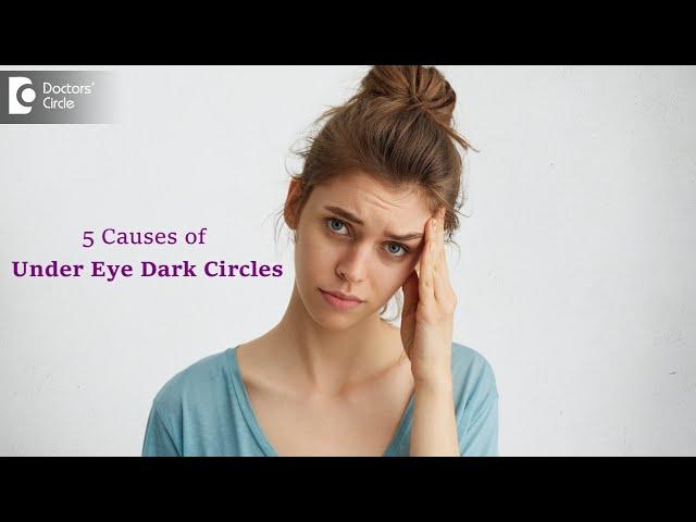 5 Top Causes of Dark Circles | Know what Causes Dark Circles? - Dr. Renuka Shetty | Doctors' Circle