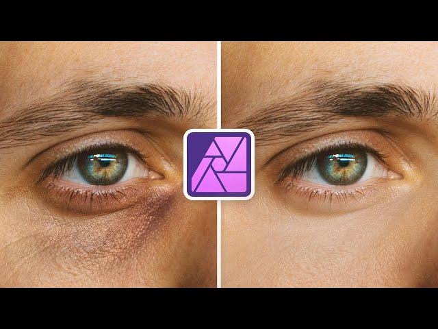 How to Remove Dark Circles in Affinity Photo