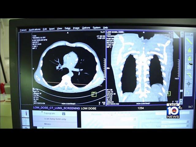 American Lung Association releases information about lung cancer rates in Florida