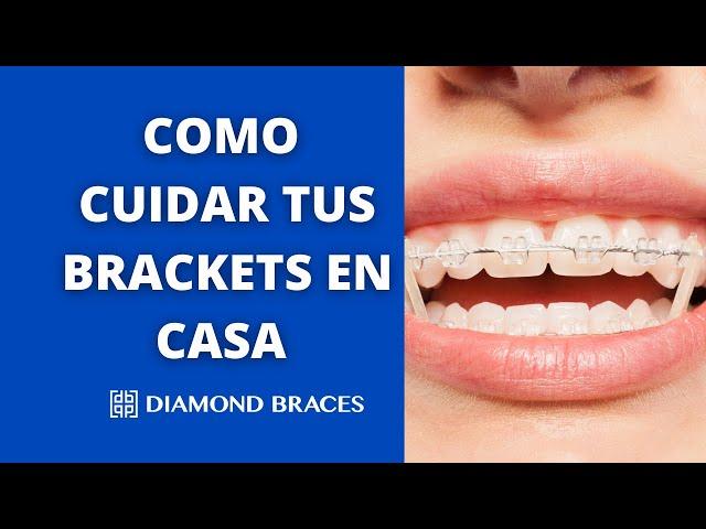 Cómo Cuidar Tus Brackets: Cepillado, Alimentos y Consejos | Diamond Braces