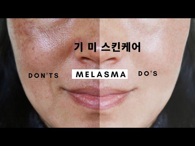 Skin Whitening at Home for Hyperpigmentation, Melasma l Korean Skincare l Dermatologist Dr. Judy
