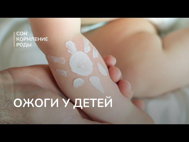 Ожоги у детей