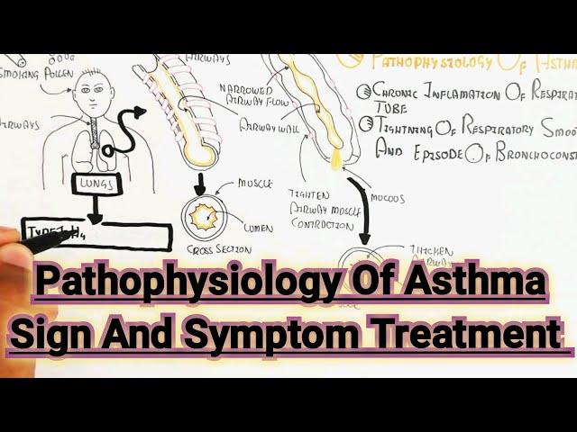 Pathophysiology Of Asthma Sign And Symptom Treatment @umerfarooqbiology7083