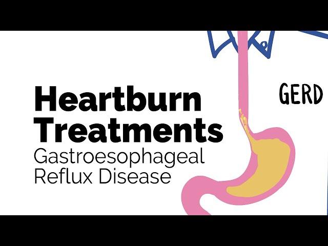 Treatments for Heartburn | Gastroesophageal Reflux Disease (GERD) | Gastrointestinal Society