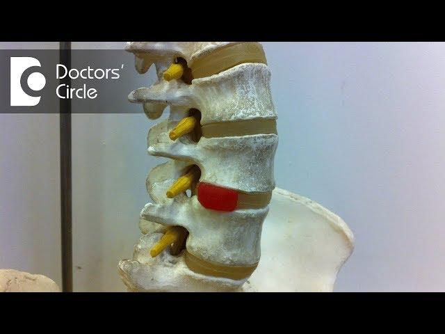 What are the treatment modalities if you are HLA B 27 positive? - Dr. Sanjay Gupta