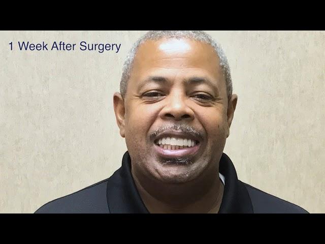 All-on-4 Dental Implant Remakes Anthony's Smile