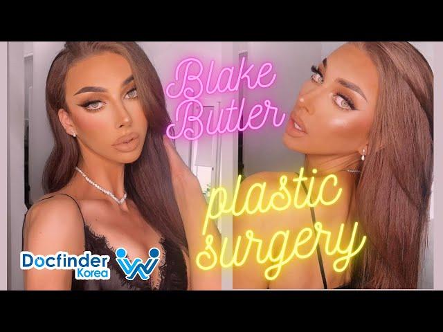 FACIAL FEMINIZATION SURGERY - AMAZING TRANSFORMATION | Blake Butler