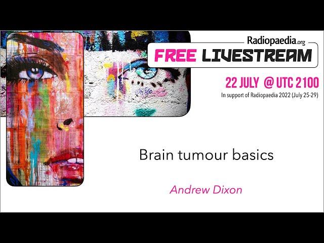 Brain tumour basics - Andrew Dixon (Featured Video)