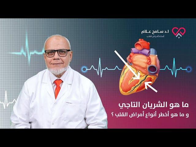 ما هو الشريان التاجي و ما هو أخطر أنواع أمراض القلب ؟ دكتور سامح علام