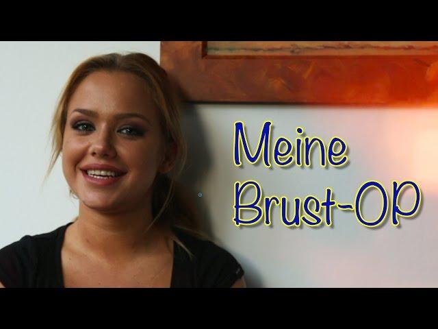 MEINE BRUST-OP | KIM GLOSS