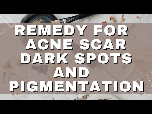 How To Get Rid Of Acne Scar & Dark Spots | Pigmentation | #scor | Pimple Marks | Tried & Tested