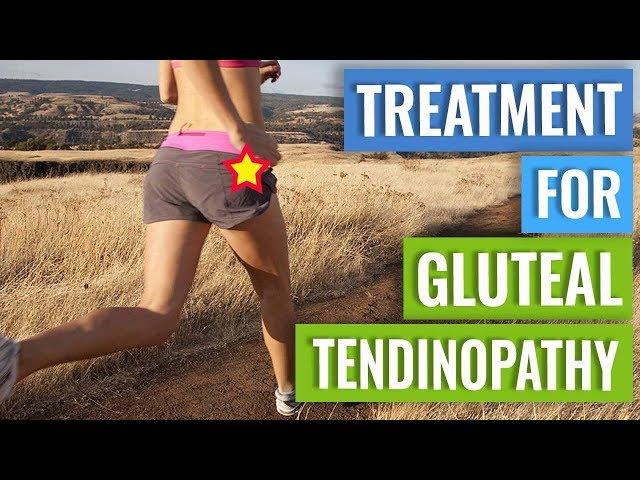 Treatment for Gluteal Tendinopathy