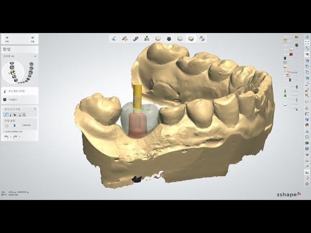 3shape Custom abut Design)커스텀어버트 디자인 누구나 쉽게 배워보자!_간단 툴 사용법