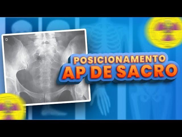 POSICIONAMENTO - AP DE SACRO | Radiologando