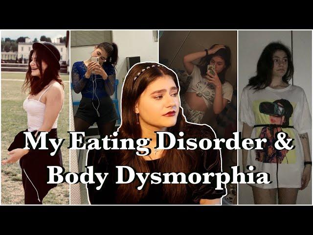 My Life with an Eating Disorder & Body Dysmorphia  * how it ruined my favourite thing in the world*