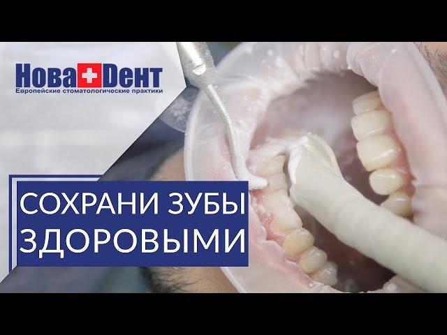  В чем эффективность профессиональной гигиены полости рта. Профессиональная гигиена полости рта.12+