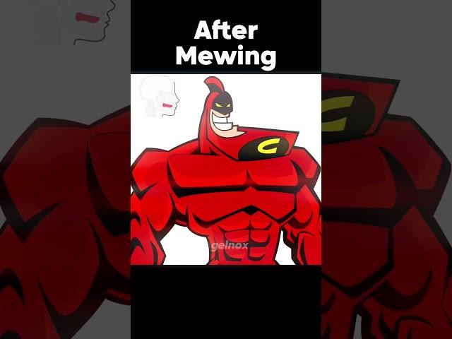 Mewing Transformation