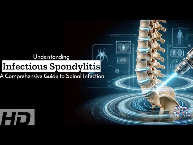 Infectious Spondylitis Uncovered: A Deep Dive into Spinal Infections