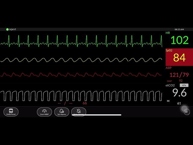 Simulated Patient Monitor