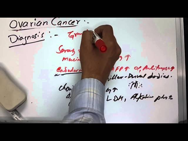 Ovarian Cancer 3 of 3 (Symptoms/Diagnosis/Treatment)