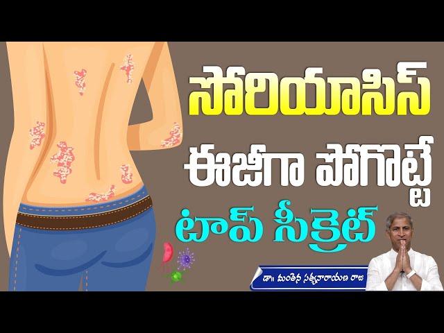 Wheatgrass Juice | How to Cure Psoriasis | Skin Allergy Treatment | Manthena Satyanarayana Raju