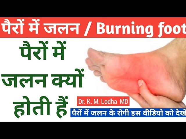 #Pero me jalan kyo hoti hai#पैरों के तलवों में जलन क्यों होती हैं #Burning feet sensation #DrKMLodha