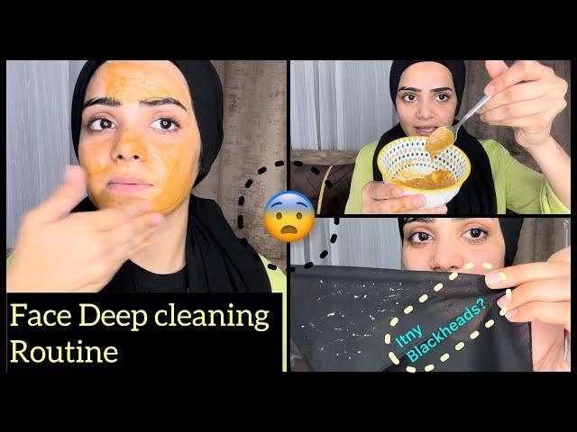 This Is How I Remove My Blackheads On Face  |  Live Results |Dietitian Aqsa