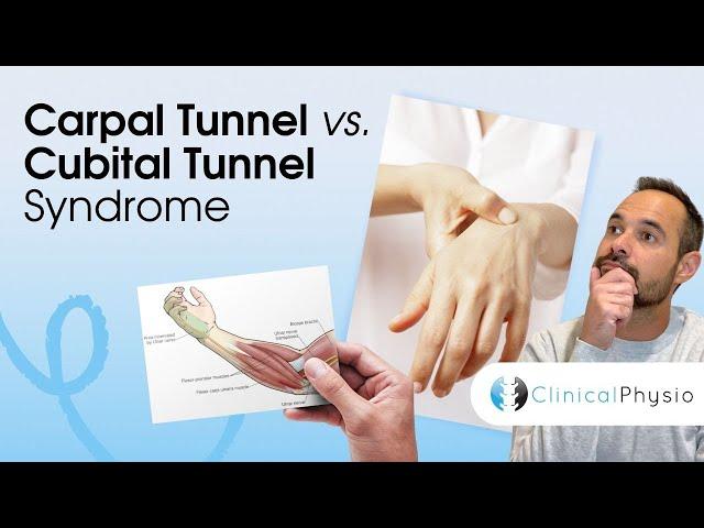 Carpal Tunnel Syndrome vs. Cubital Tunnel Syndrome | Expert Physio Guide