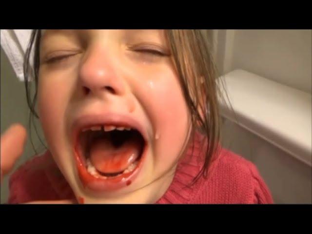 Baby Annabelle bloody tooth freaks outVictoria & freak daddy save the day day ( reuploaded )