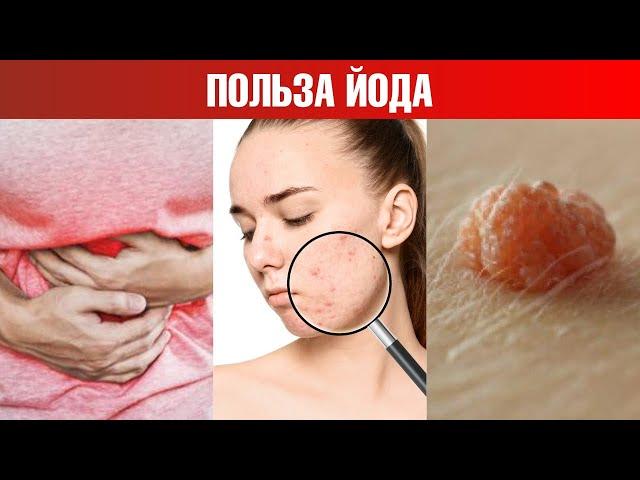 Как определить дефицит йода дома?  Польза йода