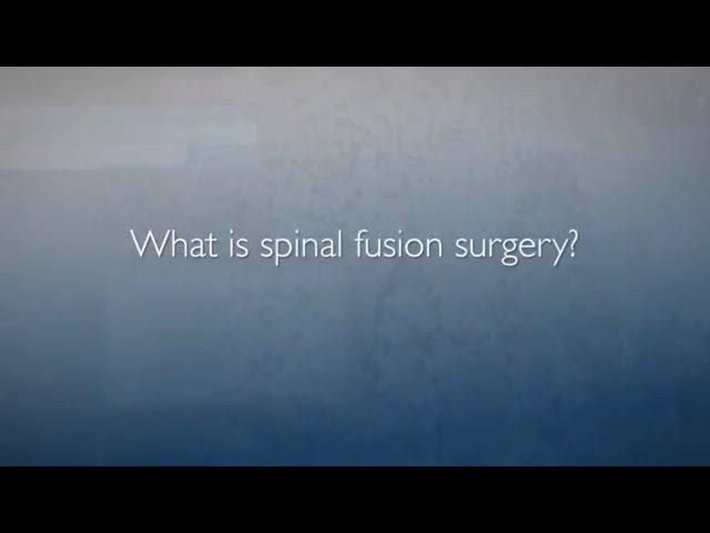 Approaches to Spinal Fusion | FAQ's
