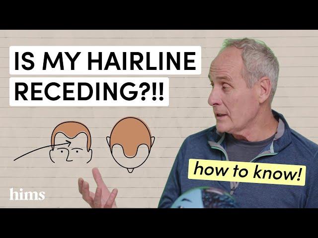 Decoding Hair Loss: Understanding the Norwood Scale