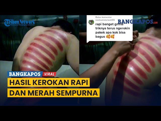 Video Pria Kerokan ini Viral, Hasilnya Rapi Sempurna Bikin Kagum Warganet