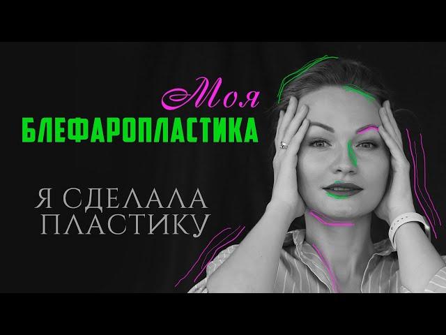 Моя верхняя блефаропластика. История моей операции. Пластический хирург Силкина Кристина