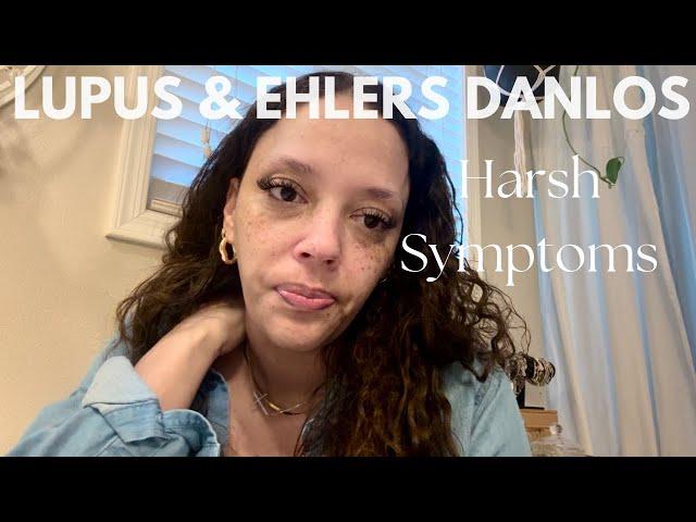 Fighting Lupus & Ehlers Danlos Syndrome// There is no control// Chronic Illness Warrior