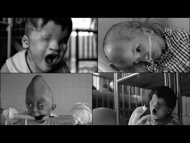 Agent Orange | The Chemical That Destroyed Generations