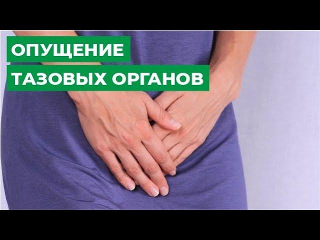 Опущение тазовых органов