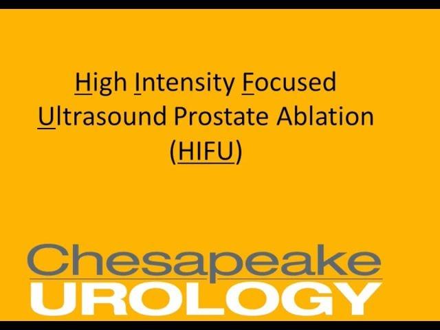 The Facts About the Minimally Invasive HIFU Treatment for Prostate Cancer