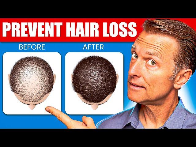 12 Proven Remedies to Prevent Hair Loss and Regrowth Regrow hair