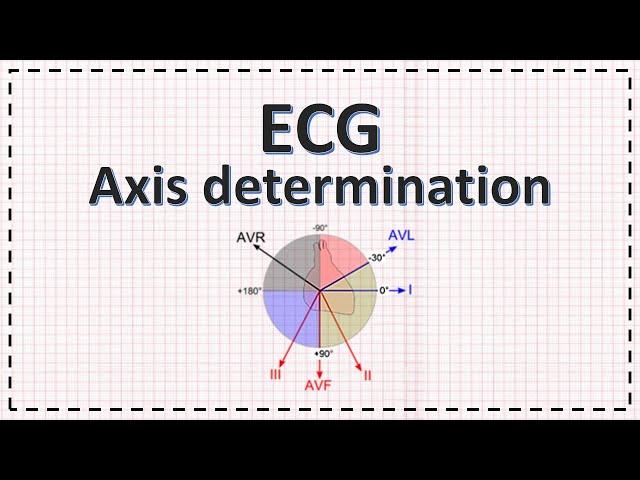 Cardiac Axis Determination | ECG Axis | Simplified
