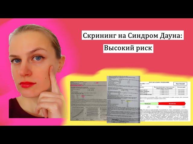 Скрининг на синдром Дауна: PAPP-A, βhCG, толщина воротникового пространства, кость носа, УЗИ-маркеры